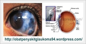 obat penyakit glaukoma